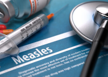 Measles cases confirmed in Gallatin County