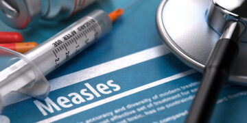 Measles cases confirmed in Gallatin County