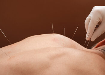 Health Buzz: Theories of acupuncture  